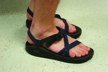 Chacos are a hot fashion trend. 