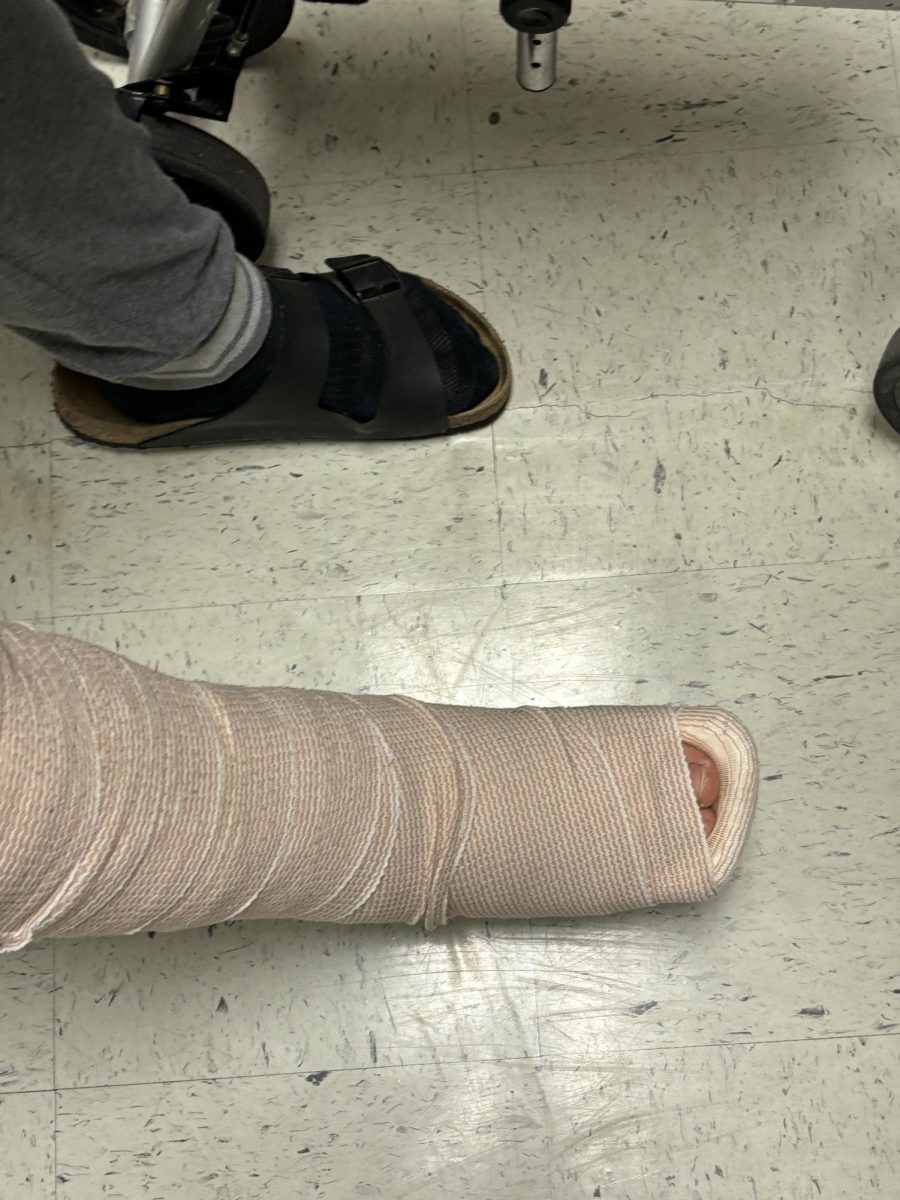 Senior Expresses Pain with After Experiencing a Broken Ankle